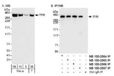Immunoprecipitation: TPR Antibody [NB100-2867]