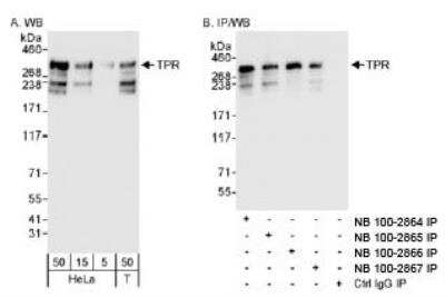 Western Blot: TPR Antibody [NB100-2864]