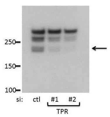 Western Blot: TPR Antibody [NB100-2864]