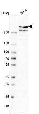 Western Blot: TPR Antibody [NBP1-89451]