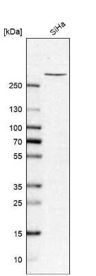 Western Blot: TPR Antibody [NBP1-89452]