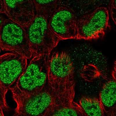 Immunocytochemistry/ Immunofluorescence: TPRG1 Antibody [NBP2-49311]