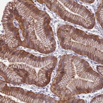 Immunohistochemistry-Paraffin: TPRG1 Antibody [NBP2-13471]