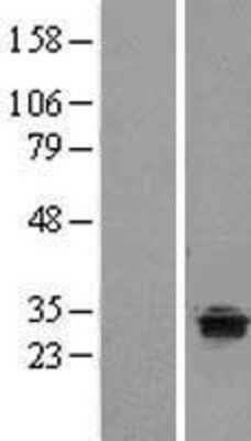 Western Blot: TPRG1 Overexpression Lysate [NBL1-17227]