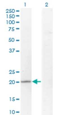 Western Blot: TPRKB Antibody (3F6) [H00051002-M01]