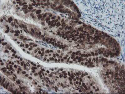 Immunohistochemistry-Paraffin: TPRKB Antibody (OTI3H3) [NBP2-03885]