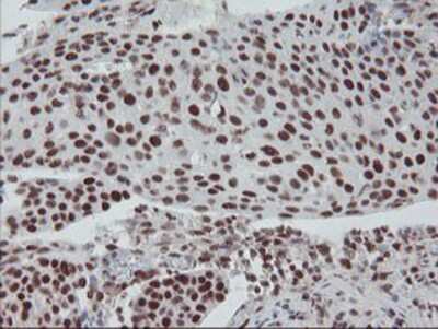 Immunohistochemistry-Paraffin: TPRKB Antibody (OTI3H3) [NBP2-03885]