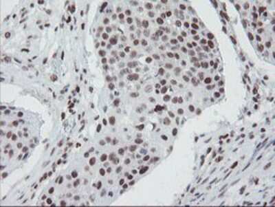 Immunohistochemistry-Paraffin: TPRKB Antibody (OTI3H3) [NBP2-03885]