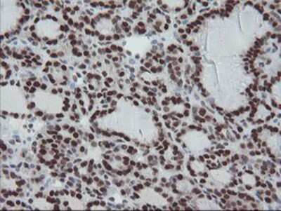 Immunohistochemistry-Paraffin: TPRKB Antibody (OTI3H3) [NBP2-03885]