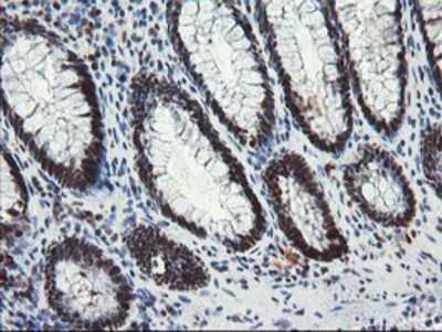 Immunohistochemistry-Paraffin: TPRKB Antibody (OTI3H3) [NBP2-03885]
