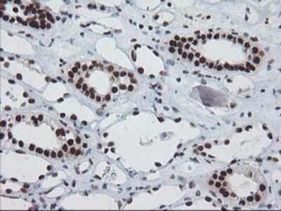 Immunohistochemistry-Paraffin: TPRKB Antibody (OTI3H3) [NBP2-03885]