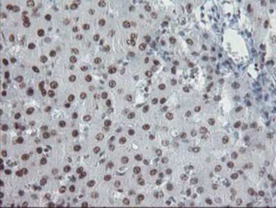 Immunohistochemistry-Paraffin: TPRKB Antibody (OTI3H3) [NBP2-03885]