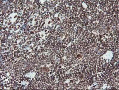 Immunohistochemistry-Paraffin: TPRKB Antibody (OTI3H3) [NBP2-03885]