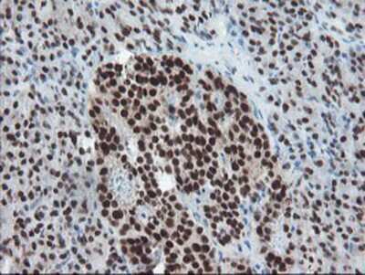 Immunohistochemistry-Paraffin: TPRKB Antibody (OTI3H3) [NBP2-03885]