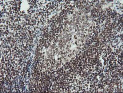 Immunohistochemistry-Paraffin: TPRKB Antibody (OTI3H3) [NBP2-03885]