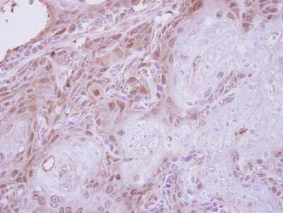 Immunohistochemistry-Paraffin: TPRKB Antibody [NBP1-31618]