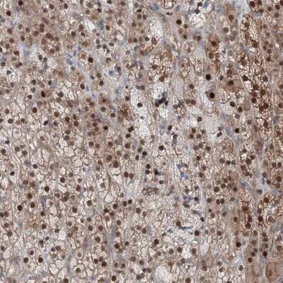 Immunohistochemistry-Paraffin: TPRKB Antibody [NBP1-85665]