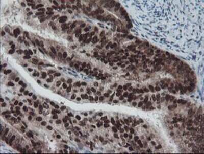 Immunohistochemistry: TPRKB Antibody (OTI3H3) - Azide and BSA Free [NBP2-74574]