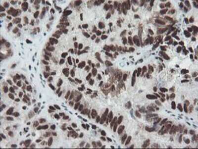 Immunohistochemistry: TPRKB Antibody (OTI3H3) - Azide and BSA Free [NBP2-74574]