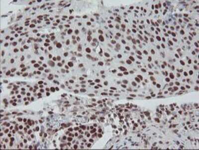Immunohistochemistry: TPRKB Antibody (OTI3H3) - Azide and BSA Free [NBP2-74574]