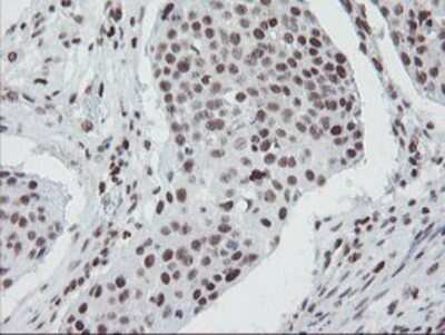 Immunohistochemistry: TPRKB Antibody (OTI3H3) - Azide and BSA Free [NBP2-74574]