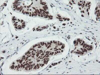 Immunohistochemistry: TPRKB Antibody (OTI3H3) - Azide and BSA Free [NBP2-74574]