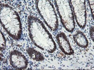 Immunohistochemistry: TPRKB Antibody (OTI3H3) - Azide and BSA Free [NBP2-74574]