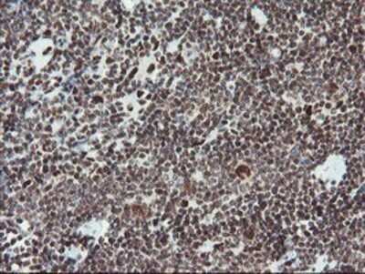 Immunohistochemistry: TPRKB Antibody (OTI3H3) - Azide and BSA Free [NBP2-74574]