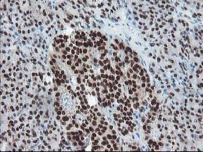 Immunohistochemistry: TPRKB Antibody (OTI3H3) - Azide and BSA Free [NBP2-74574]