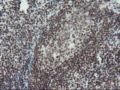Immunohistochemistry: TPRKB Antibody (OTI3H3) - Azide and BSA Free [NBP2-74574]