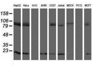 Western Blot: TPRKB Antibody (OTI3H3)Azide and BSA Free [NBP2-74574]