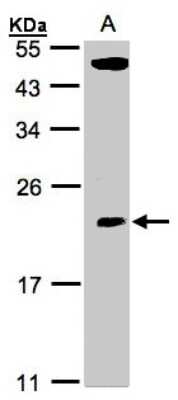 Western Blot: TPRKB Antibody [NBP1-31618]