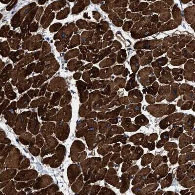 Immunohistochemistry-Paraffin: TPRN Antibody [NBP1-86697]