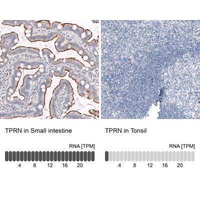 Immunohistochemistry-Paraffin: TPRN Antibody [NBP1-86697]