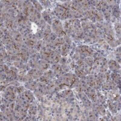 Immunohistochemistry-Paraffin: TPRN Antibody [NBP3-17181]