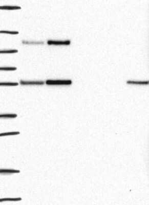 Western Blot: TPRN Antibody [NBP3-17181]