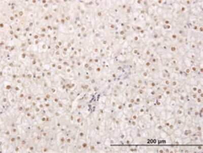 Immunohistochemistry-Paraffin: TPRX1 Antibody (2B4) [H00284355-M02]