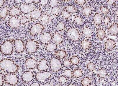 Immunohistochemistry-Paraffin: TPRX1 Antibody [NBP2-98200]