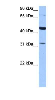 Western Blot: TPRXL Antibody [NBP1-91423]