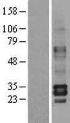 Western Blot: Tryptase beta-2/TPSB2 Overexpression Lysate [NBL1-17230]