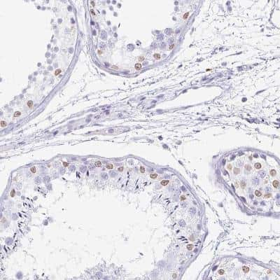 Immunohistochemistry-Paraffin: TPSD1 Antibody [NBP2-31981]