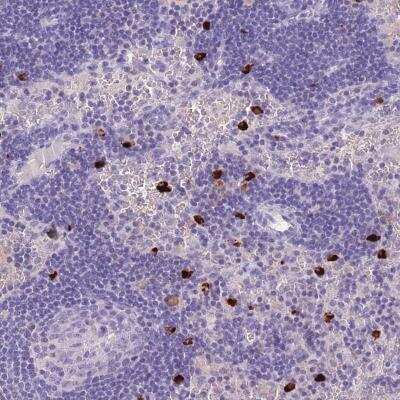 Immunohistochemistry: TPSD1 Antibody [NBP2-46776]