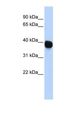 Western Blot: Tyrosylprotein Sulfotransferase 2/TPST2 Antibody [NBP1-60025]