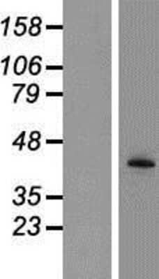 Western Blot: Tyrosylprotein Sulfotransferase 2/TPST2 Overexpression Lysate [NBP2-07978]