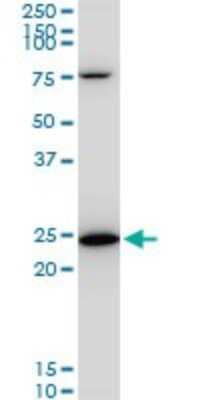 Western Blot: TPT1/TCTP Antibody (2A3) [H00007178-M06]