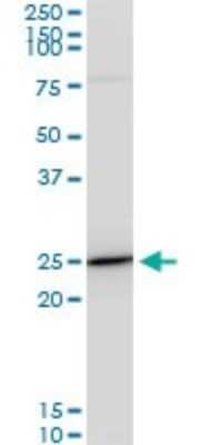 Western Blot: TPT1/TCTP Antibody (2A3) [H00007178-M06]