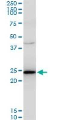Western Blot: TPT1/TCTP Antibody (2A3) [H00007178-M06]