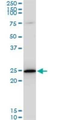 Western Blot: TPT1/TCTP Antibody (2A3) [H00007178-M06]