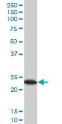 Western Blot: TPT1/TCTP Antibody (2C4) [H00007178-M03]