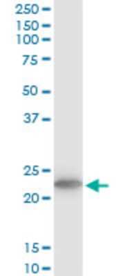 Western Blot: TPT1/TCTP Antibody (2C4) [H00007178-M03]